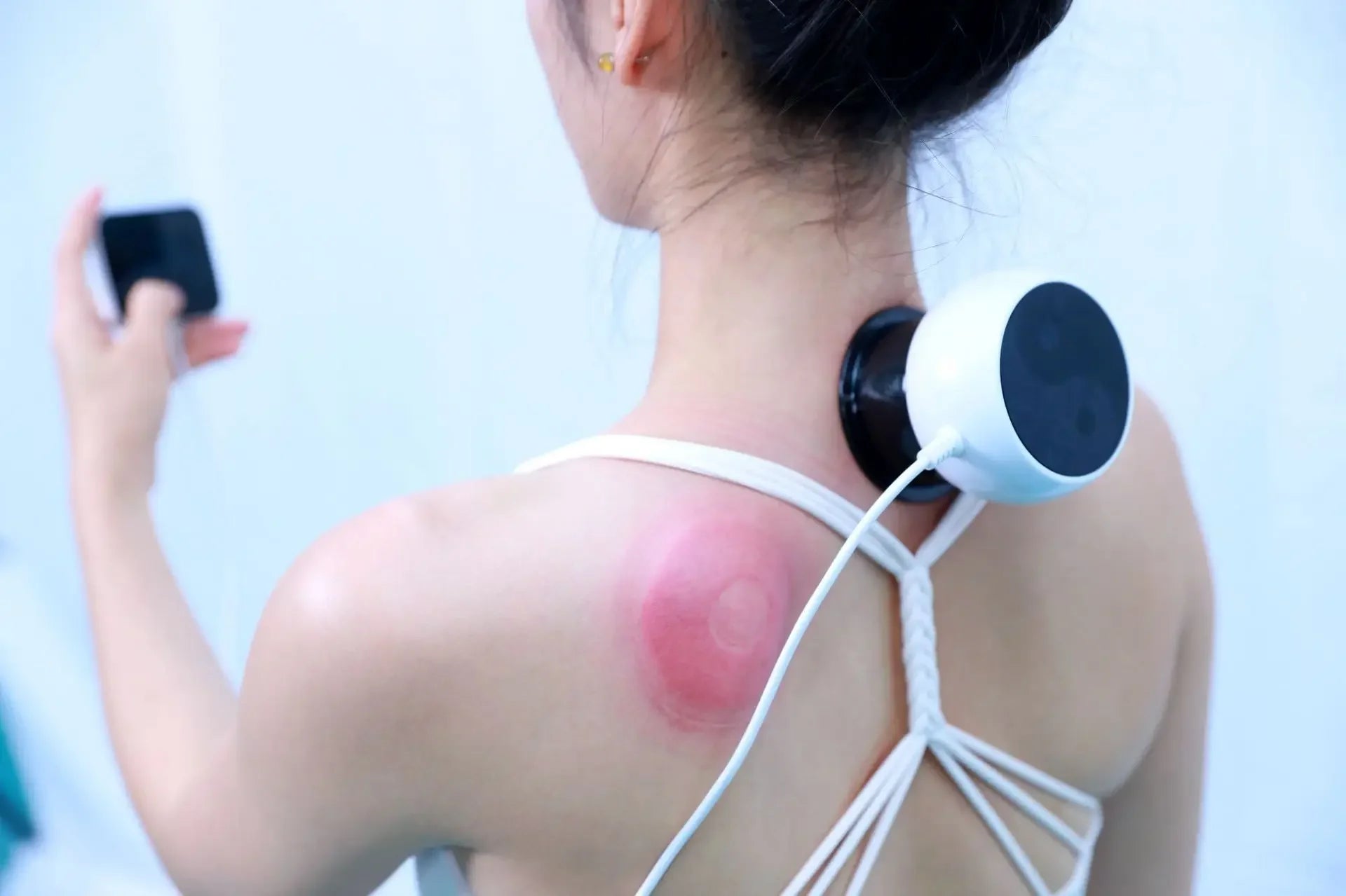 Running Tech Accessories: NEW Intelligent Vacuum Cupping Therapy - Remote Controlled Cupping Device, Smart Electric Gua Sha Cupping Machine / Rungear