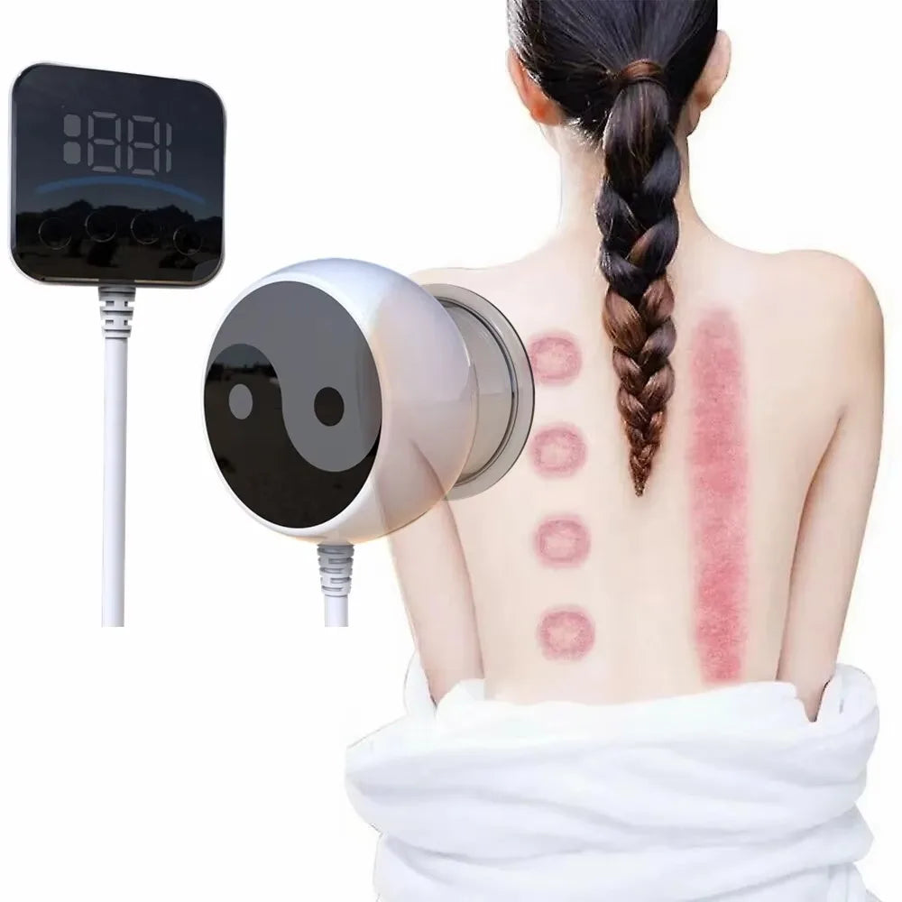 Running Tech Accessories: NEW Intelligent Vacuum Cupping Therapy - Remote Controlled Cupping Device, Smart Electric Gua Sha Cupping Machine / Rungear